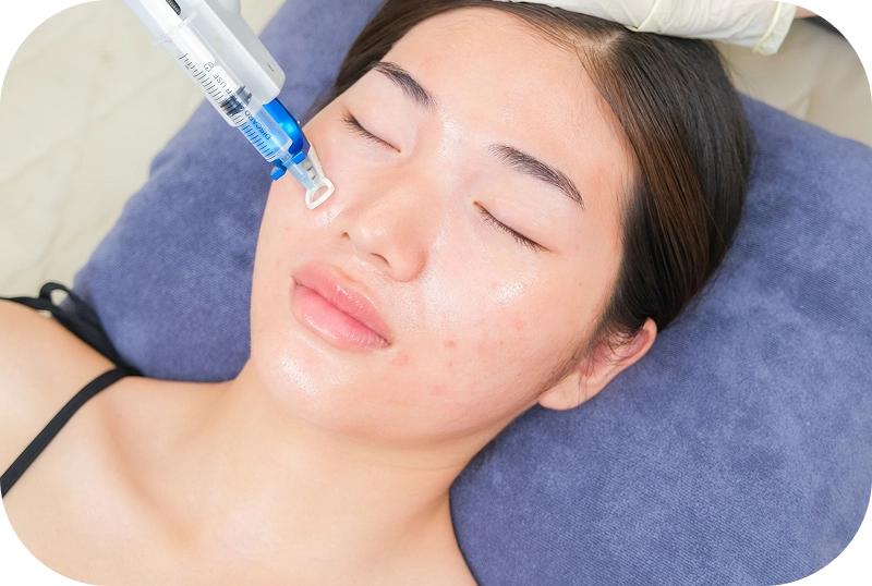 Dịch vụ điều trị tàn nhang