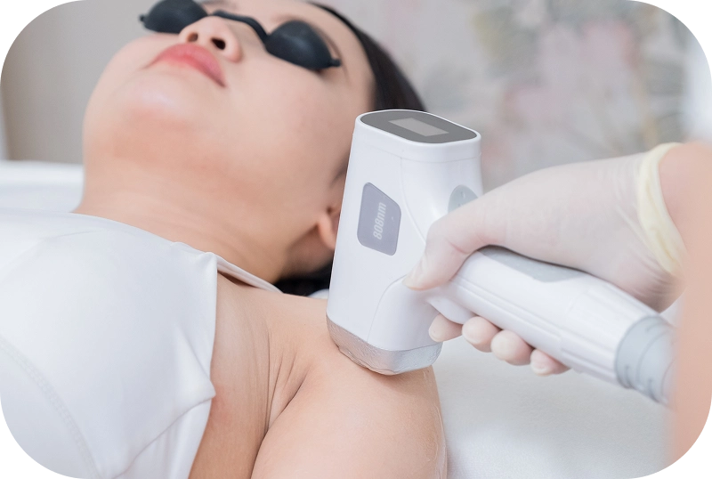 Dịch vụ triệt lông