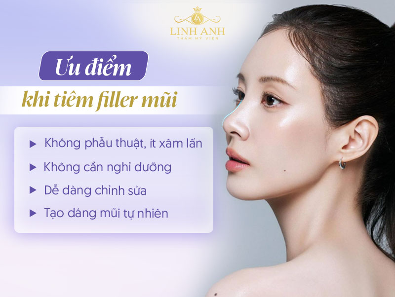 Có nên tiêm filler mũi không Có nên tiêm filler mũi không