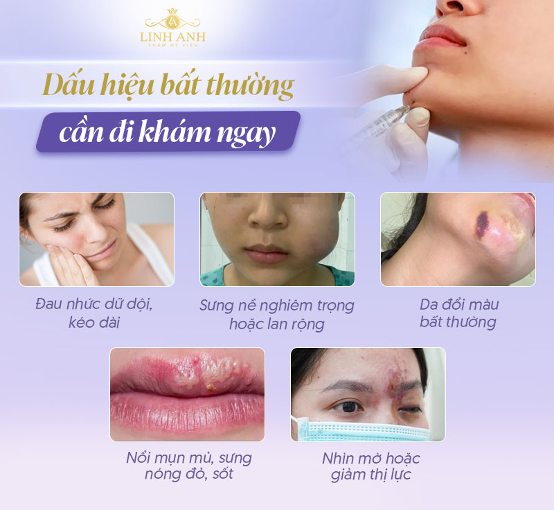 Dấu hiện filler bất thường Dấu hiện filler bất thường