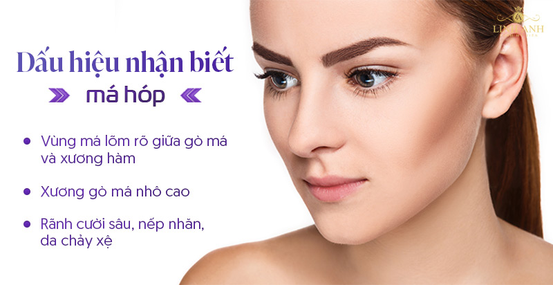 Dấu hiệu nhận biết má hóp Dấu hiệu nhận biết má hóp