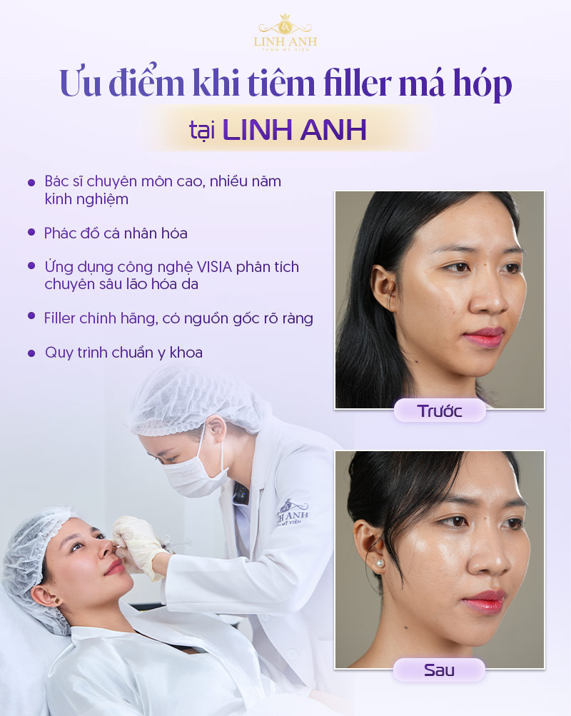 Địa chỉ tiêm filler má uy tín Địa chỉ tiêm filler má uy tín