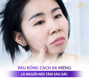 Râu rồng trên mặt là gì? Ý nghĩa tướng số và cách khắc phục