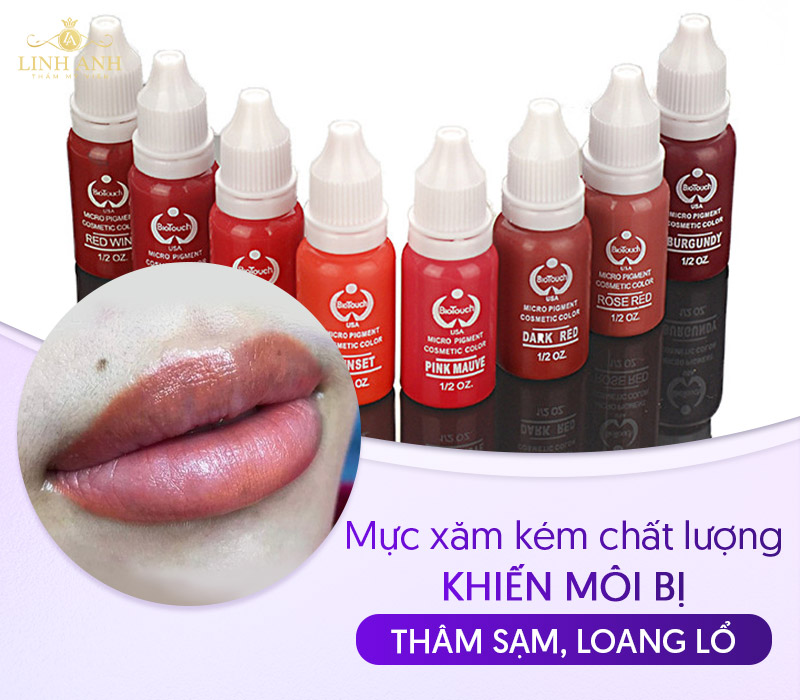 hối hận khi phun môi hối hận khi phun môi