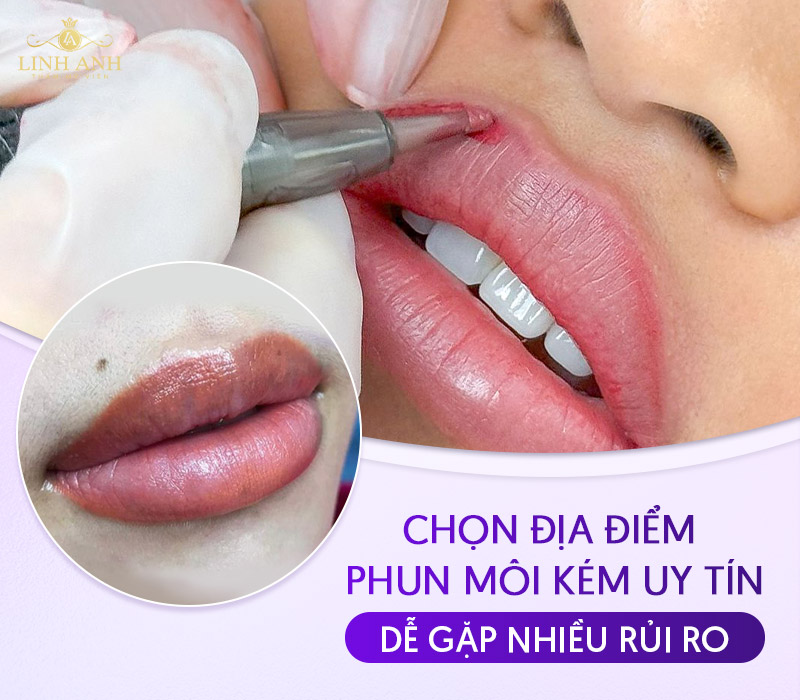 hối hận vì phun môi ở spa chui hối hận vì phun môi ở spa chui