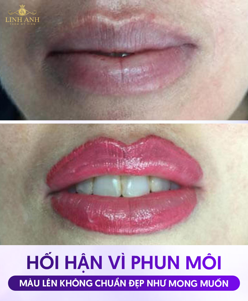 hối hận vì phun môi ở spa kém chất lượng hối hận vì phun môi ở spa kém chất lượng