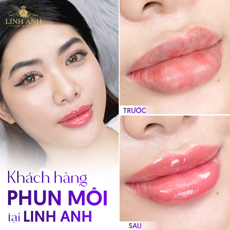 hối hận vì xăm môi ở spa kém chất lượng hối hận vì xăm môi ở spa kém chất lượng