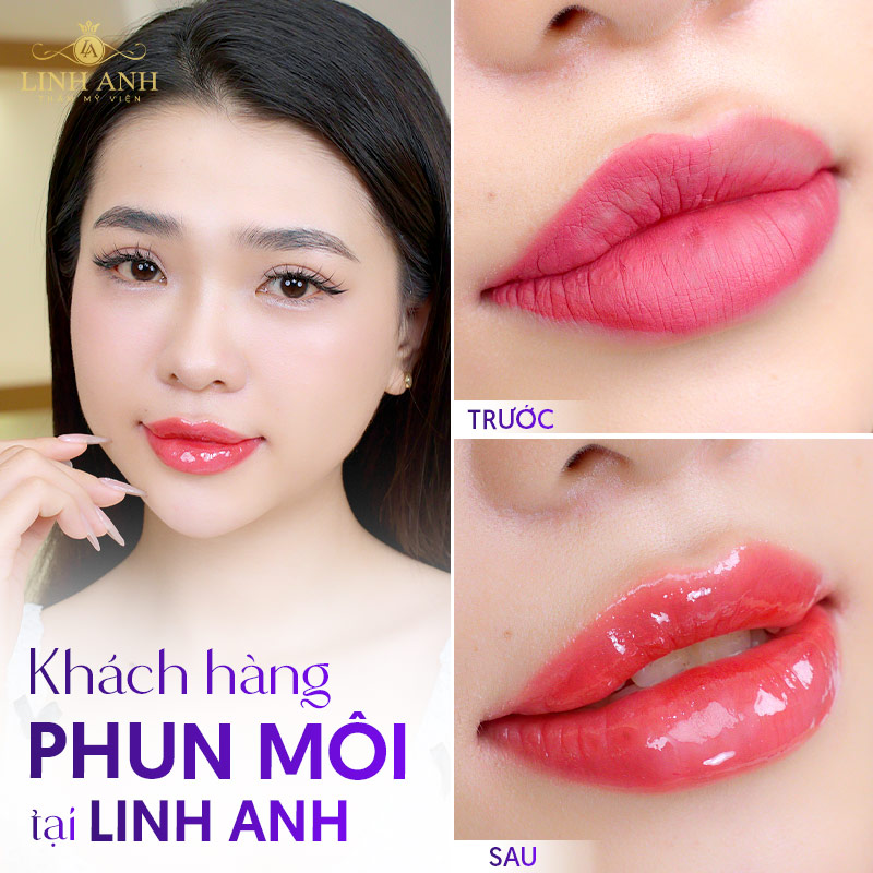 hối hận vì xăm môi ở tmv chui hối hận vì xăm môi ở tmv chui