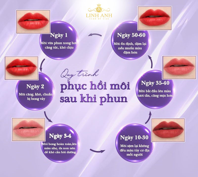 môi sau bong 10 ngày