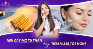 Nên cấy mỡ tự thân hay tiêm filler