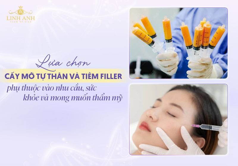 Nên cấy mỡ tự thân hay tiêm filler tốt hơn Nên cấy mỡ tự thân hay tiêm filler tốt hơn