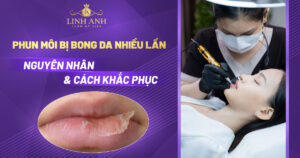phun môi bị bong da nhiều lần