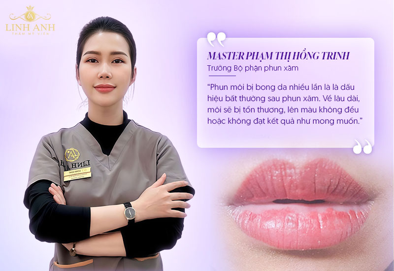 Phun môi bị bong da nhiều lần có sao không