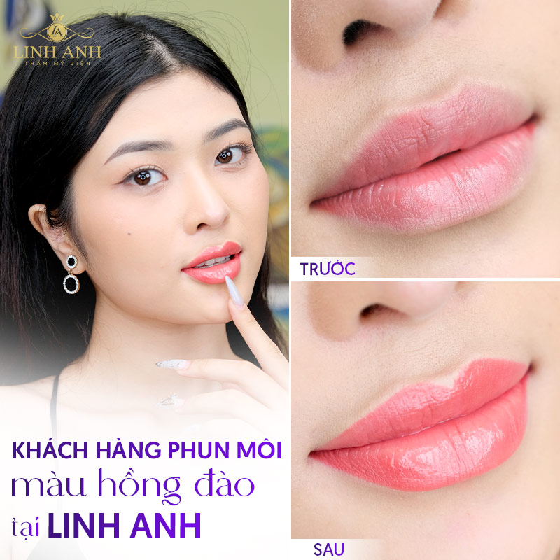 phun môi màu hồng đào sau khi bong phun môi màu hồng đào sau khi bong