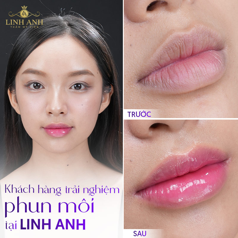 phun môi màu Hồng tự nhiên sau khi bong