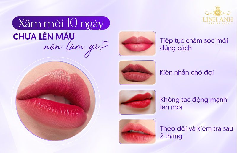 phun môi sau bong 10 ngày