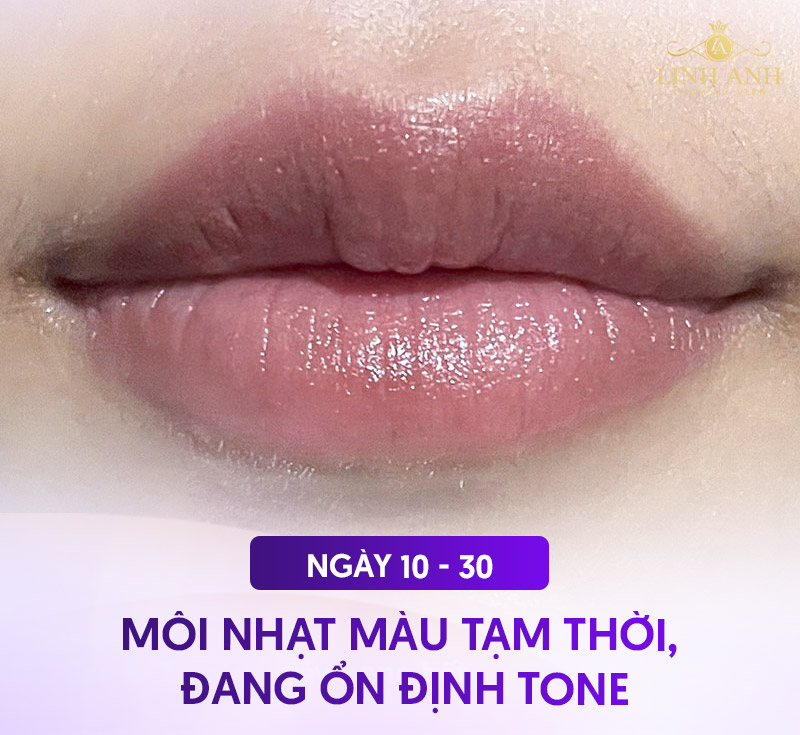 quá trình phục Hồi môi sau phun