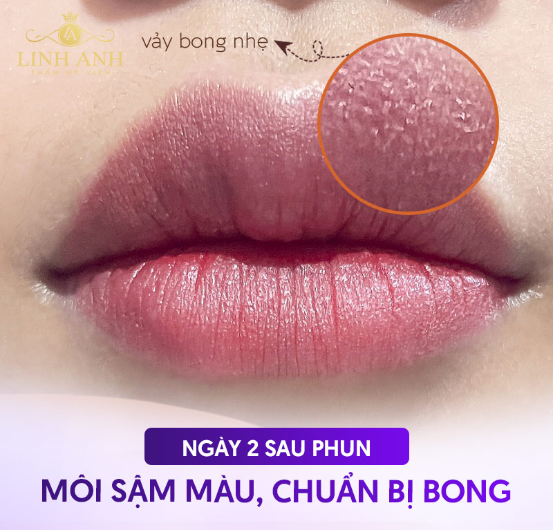 quá trình phục Hồi môi
