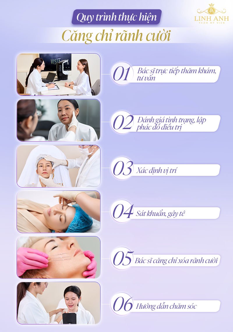 Quy trình Căng chỉ collagen rãnh cười
