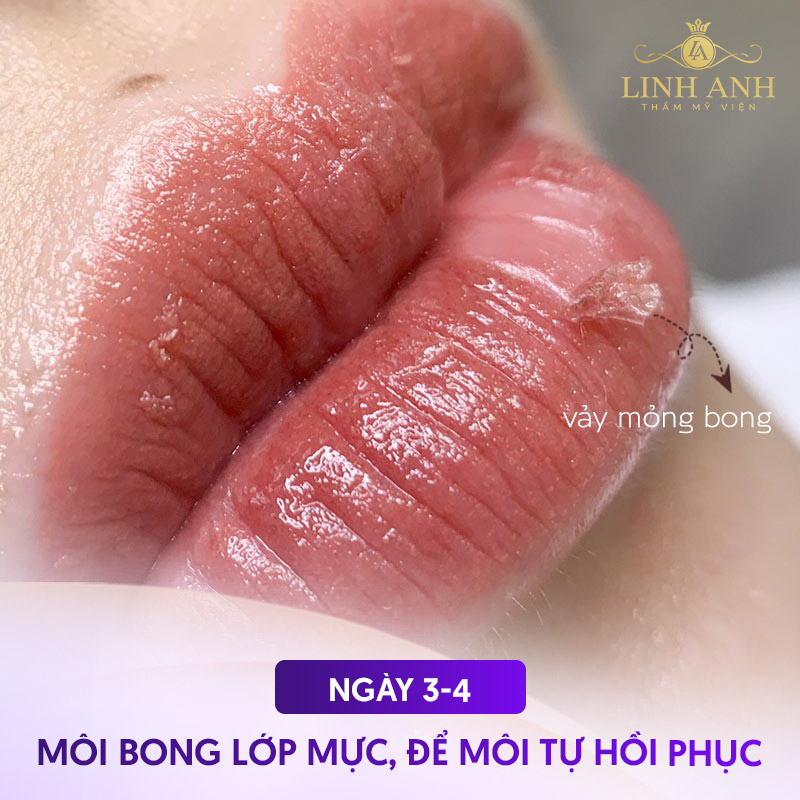 quy trình phục Hồi màu môi