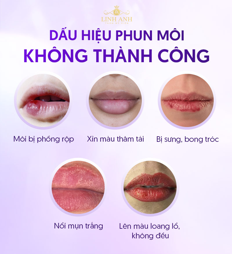 quy trình phục Hồi môi sau khi phun xăm