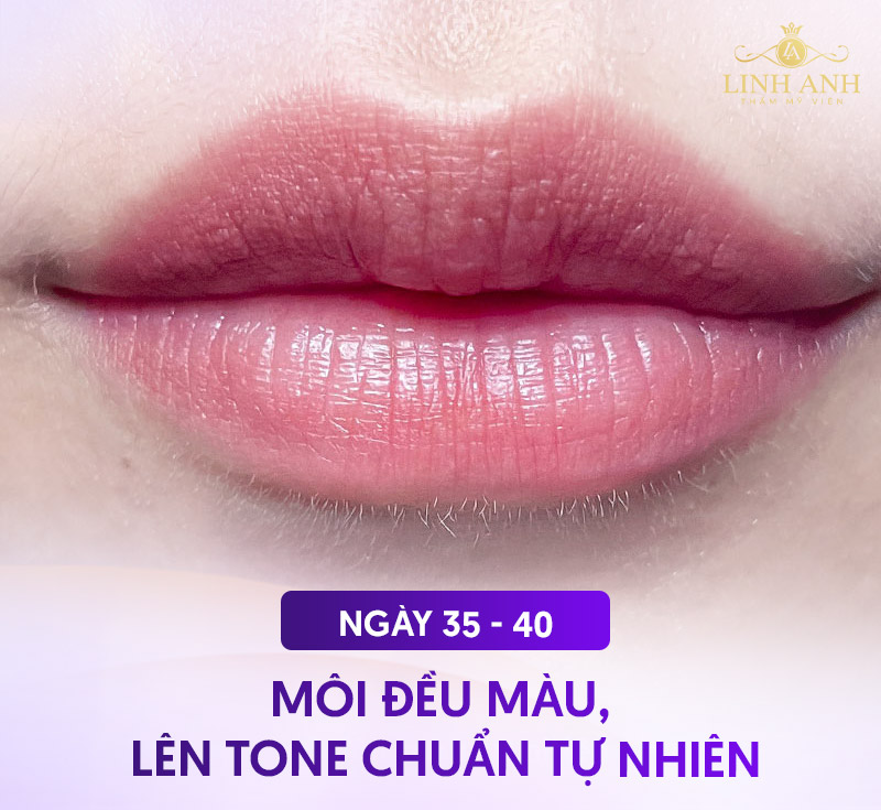 quy trình phục Hồi môi sau phun xăm