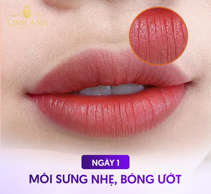 quy trình phục Hồi môi sau phun