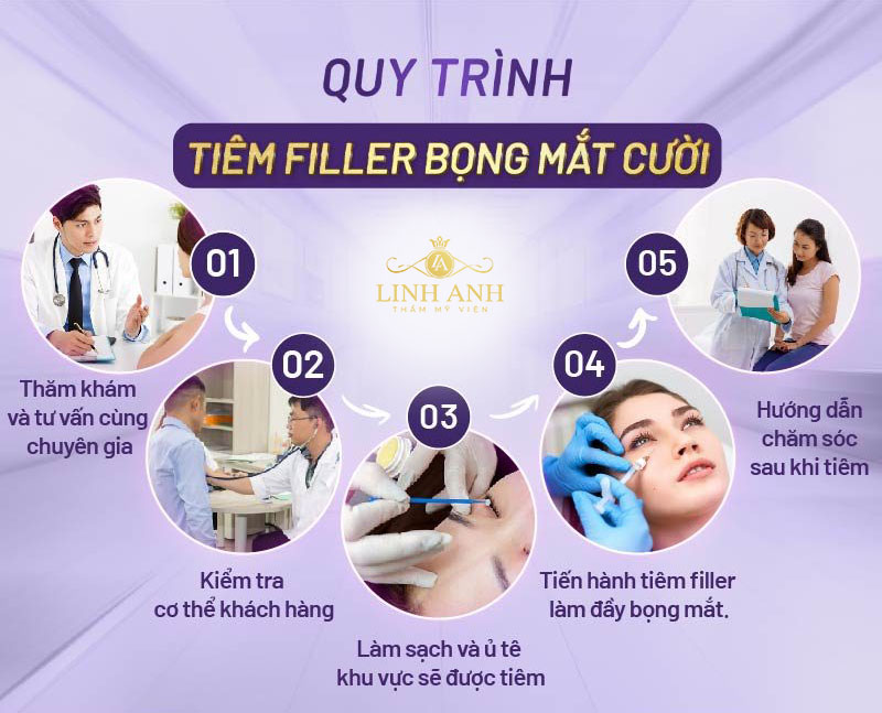 Quy trình tiêm filler bọng mắt cười chuẩn y khoa Quy trình tiêm filler bọng mắt cười chuẩn y khoa