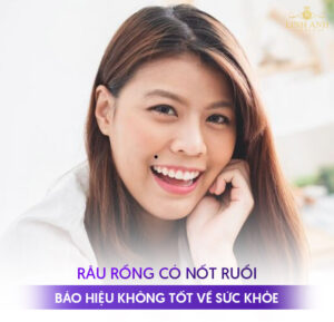 Râu rồng trên mặt là gì? Ý nghĩa tướng số và cách khắc phục