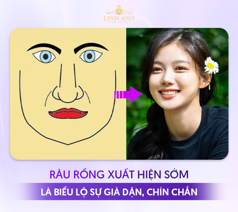 Râu rồng trên mặt là gì? Ý nghĩa tướng số và cách khắc phục