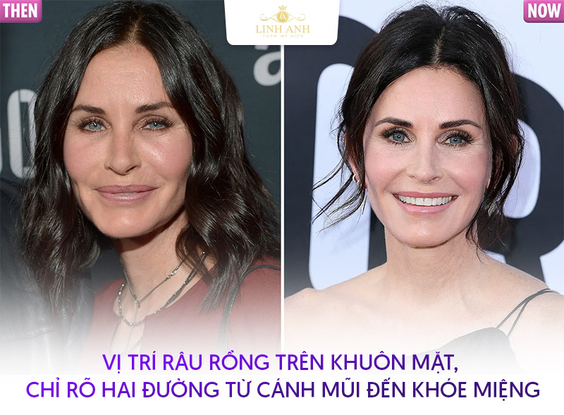 râu rồng trên mặt râu rồng trên mặt