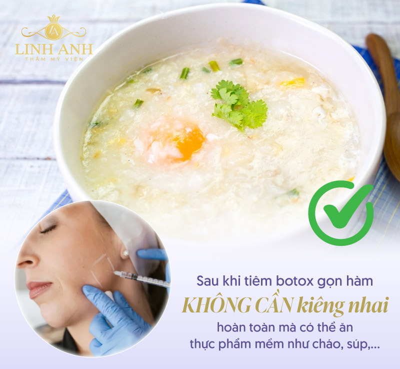 Sau tiêm botox gọn hàm có kiêng nhai không