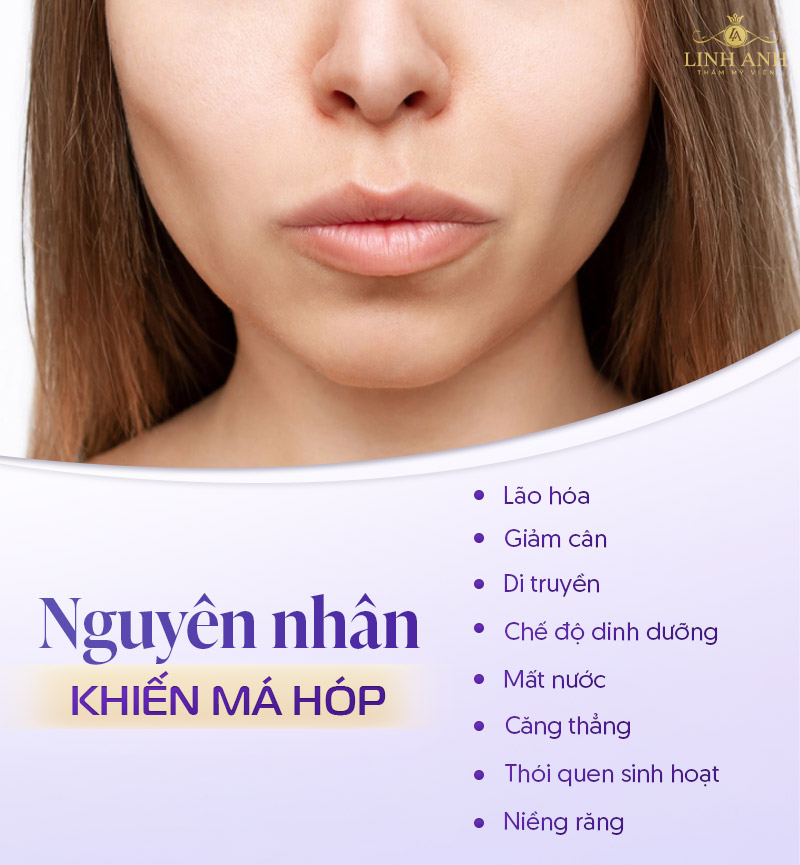 Tại sao má bị hóp