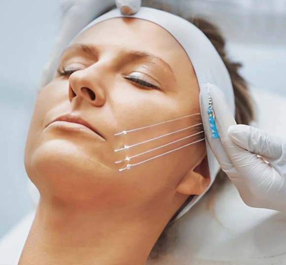 PHẪU THUẬT CĂNG DA