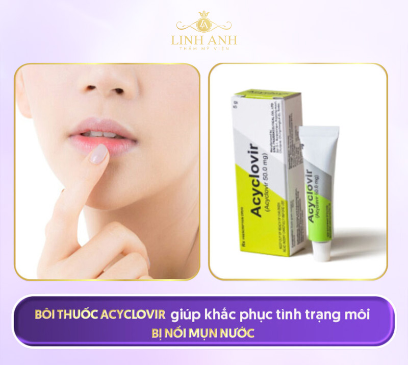 Thuốc acyclovir bôi môi