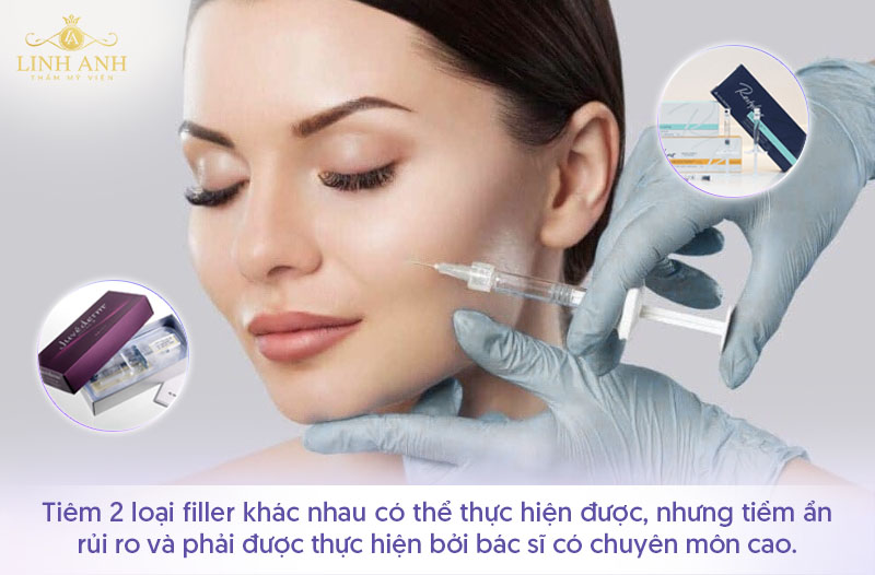 Tiêm 2 loại filler khác nhau có làm sao không