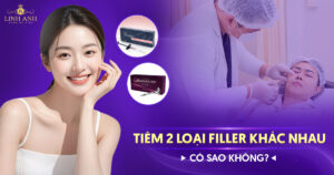 Tiêm 2 loại filler khác nhau có sao không