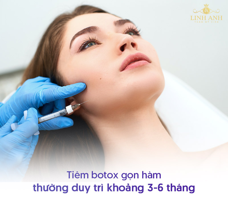 Tiêm botox gọn hàm bao lâu thì tiêm lại Tiêm botox gọn hàm bao lâu thì tiêm lại