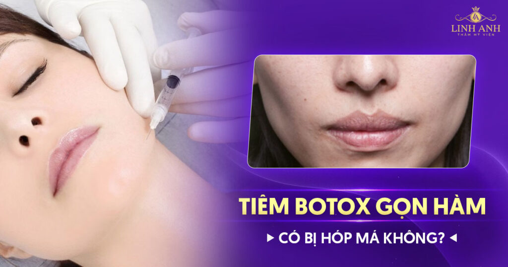 Tiêm botox gọn hàm có bị hóp má không