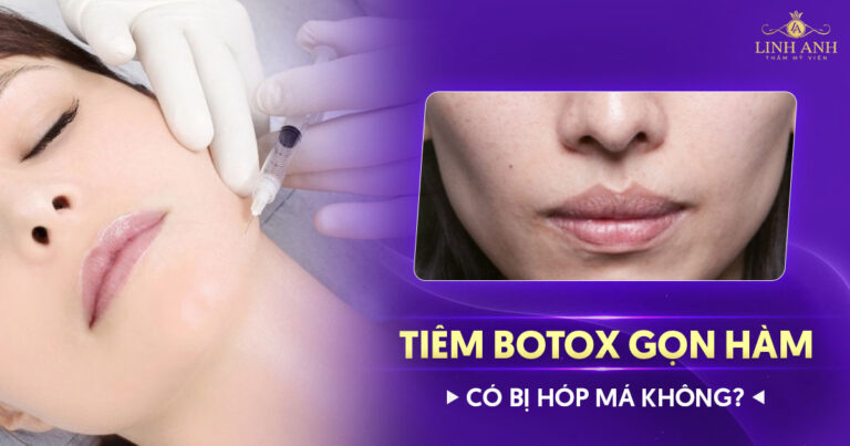 Tiêm botox gọn hàm có gây hóp má không?