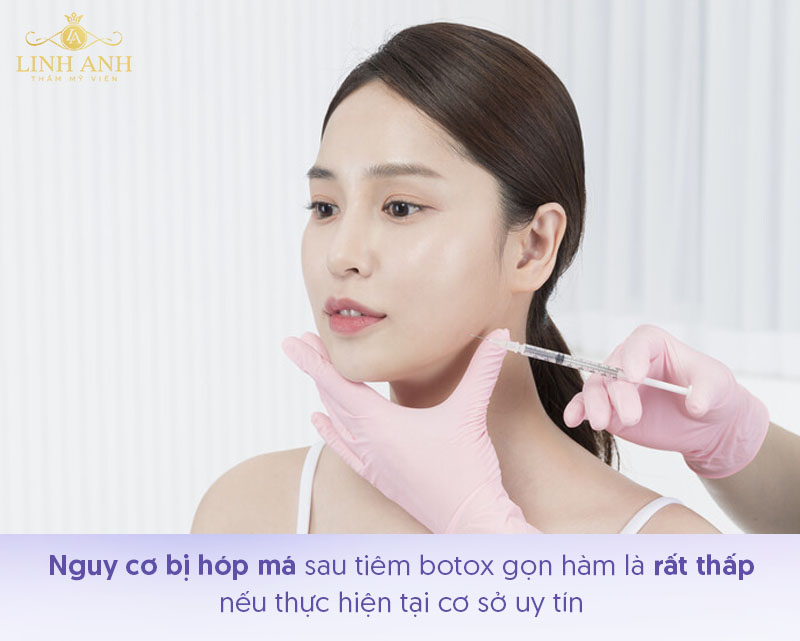 Tiêm botox gọn hàm có bị má hóp không Tiêm botox gọn hàm có bị má hóp không