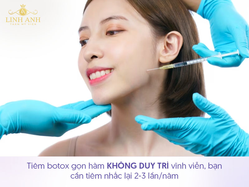 Tiêm botox gọn hàm có được vĩnh viễn không Tiêm botox gọn hàm có được vĩnh viễn không