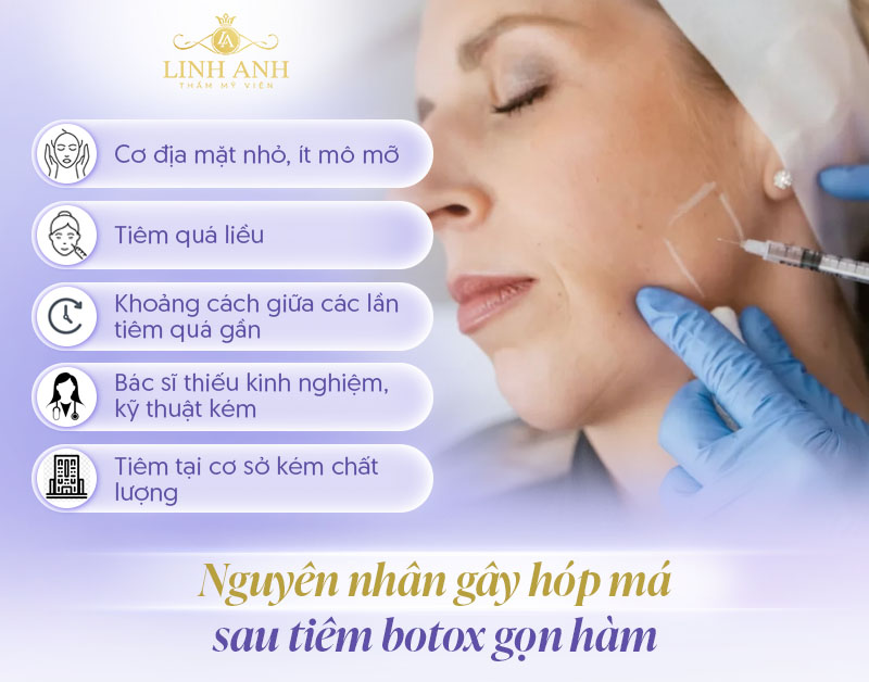 Tiêm botox gọn hàm có gây hóp má hay không Tiêm botox gọn hàm có gây hóp má hay không