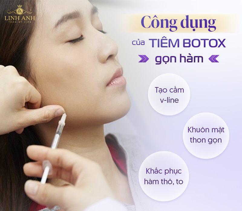Tiêm botox thon gọn hàm