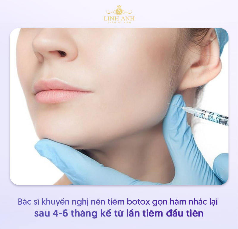 Tiêm botox thon hàm bao lâu thì tiêm lại Tiêm botox thon hàm bao lâu thì tiêm lại