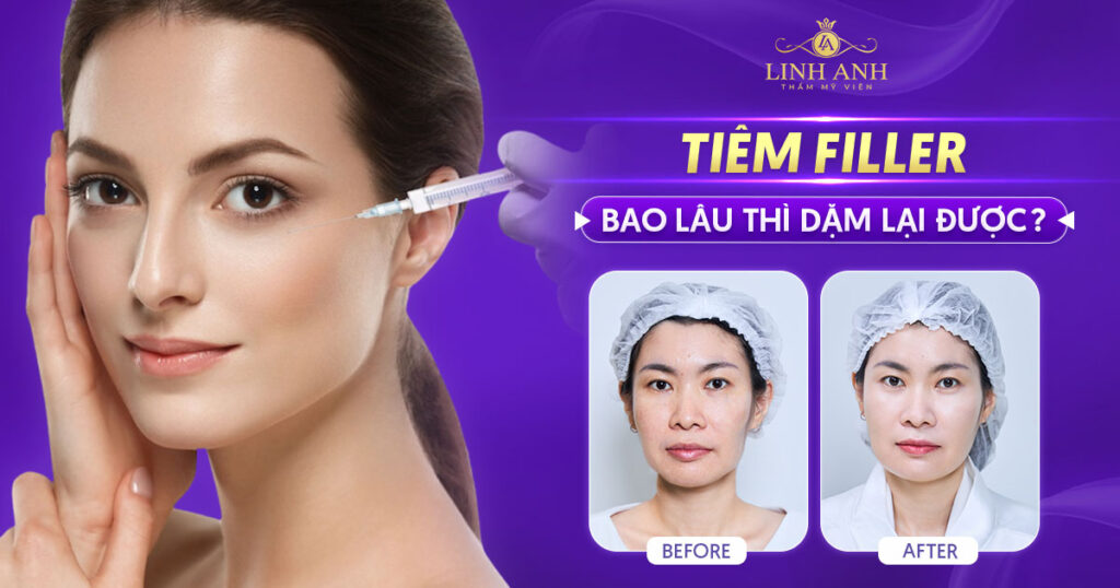 Tiêm filler bao lâu thì dặm lại được