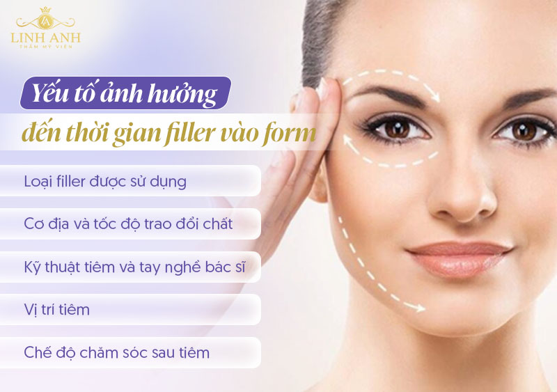 Tiêm filler bao lâu thì ổn định Tiêm filler bao lâu thì ổn định