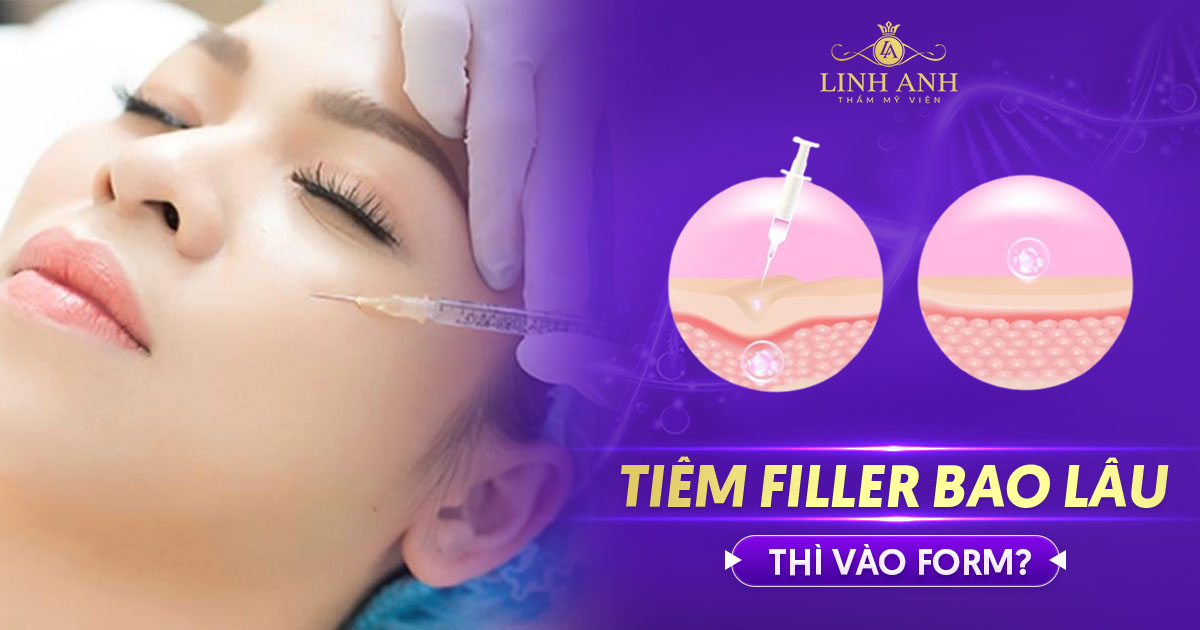 Tiêm filler bao lâu thì vào form? Cách nhận biết filler đã vào form