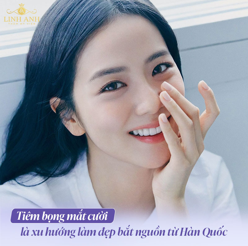 Tiêm filler bọng mắt Tiêm filler bọng mắt