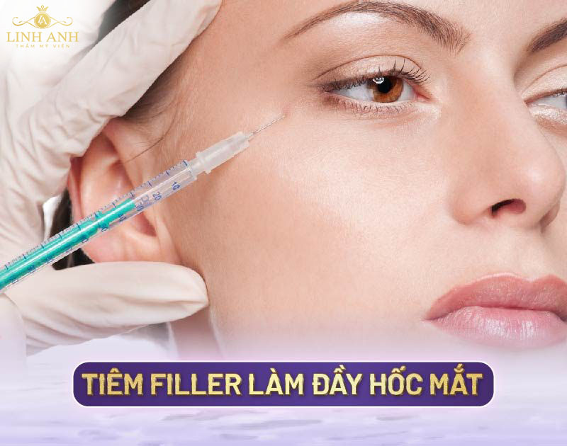 Tiêm filler đầy hốc mắt Tiêm filler đầy hốc mắt